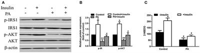 LRP6 Knockdown Ameliorates Insulin Resistance via Modulation of Autophagy by Regulating GSK3β Signaling in Human LO2 Hepatocytes